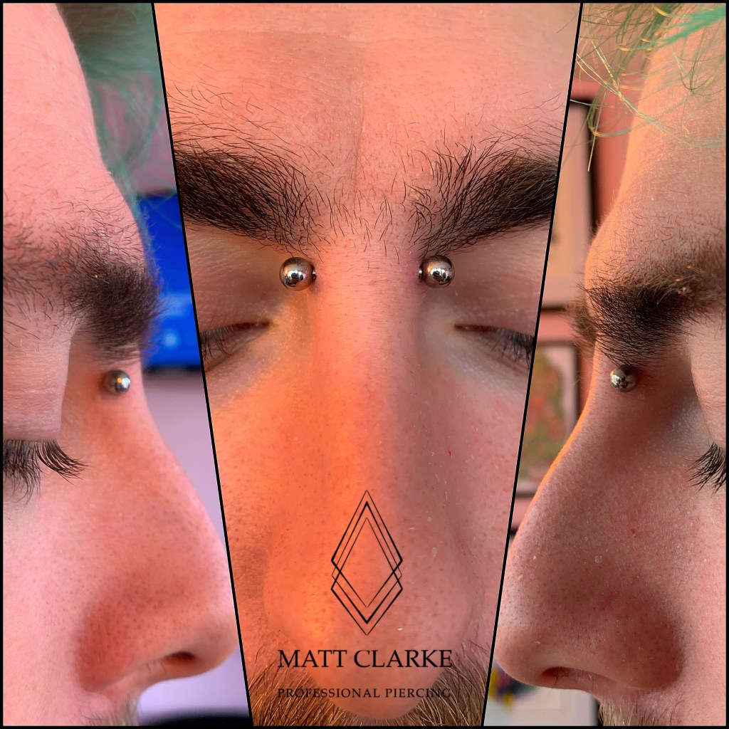 Bridge piercing with a straight barbell